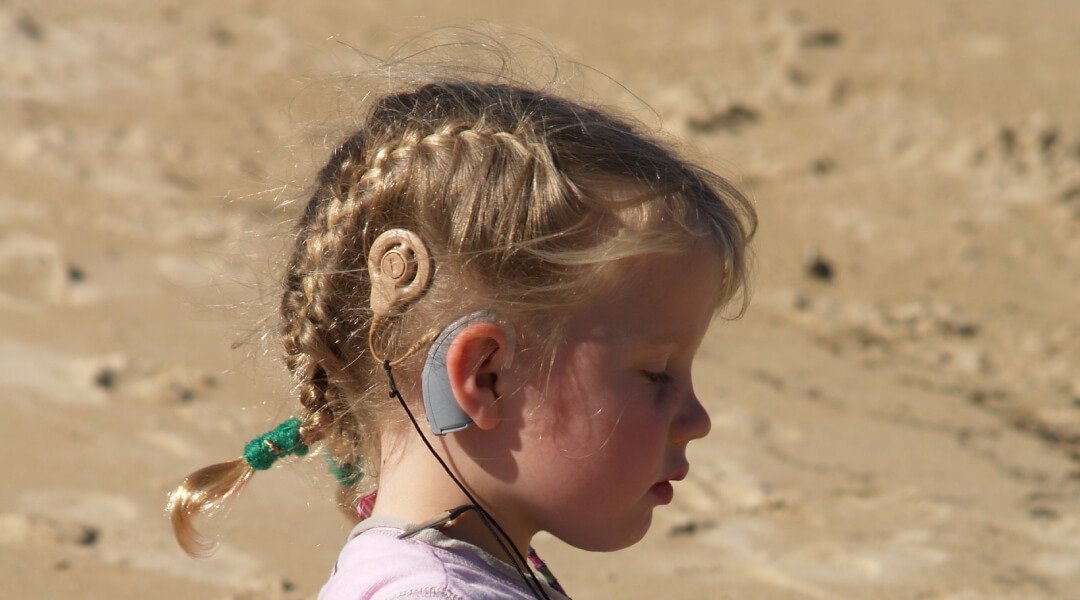 Cochlear Implant