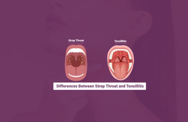 Differences Between Strep Throat and Tonsillitis