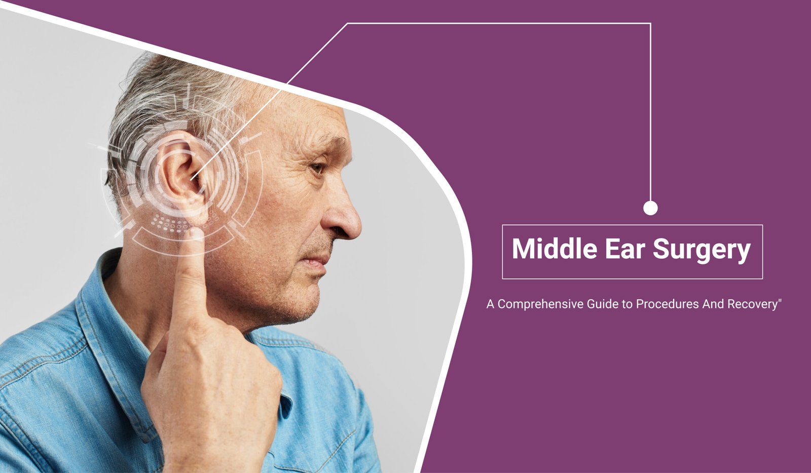 Middle Ear Surgery Procedures, Recovery Ace Neuro ENT Clinic