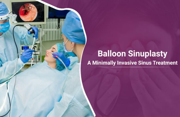 Balloon-Sinuplasty-A-Minimally-Invasive-Sinus-Treatment