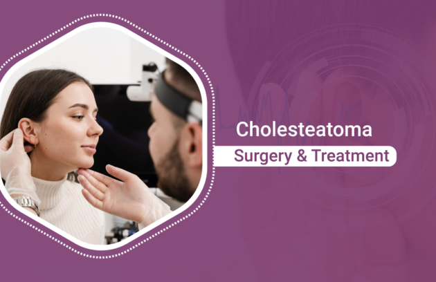 Cholesteatoma-Surgery-Diagnosis-Treatment