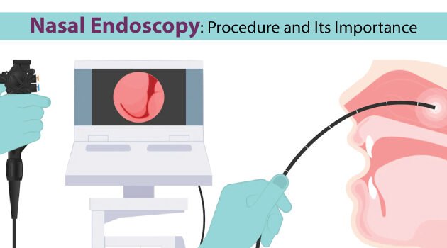 Nasal Endoscopy