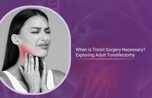 When is Tonsil Surgery Necessary Exploring Adult Tonsillectomy