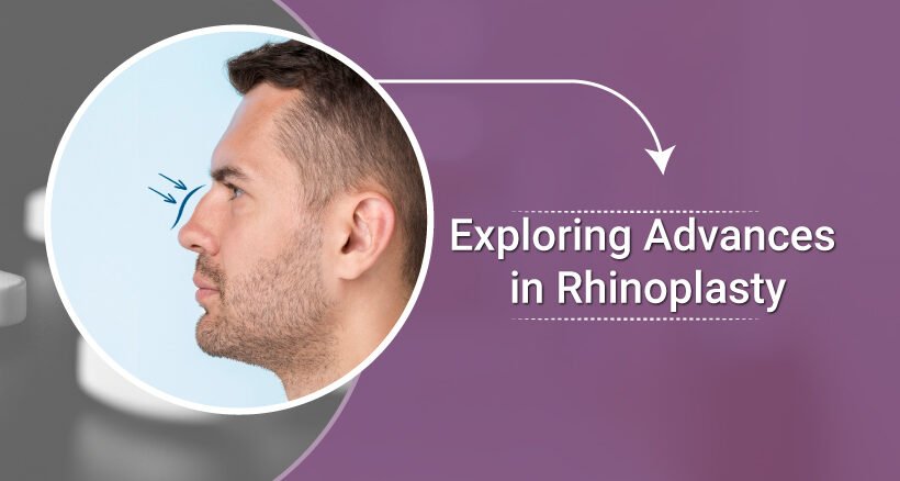 Exploring-Advances-in-Rhinoplasty