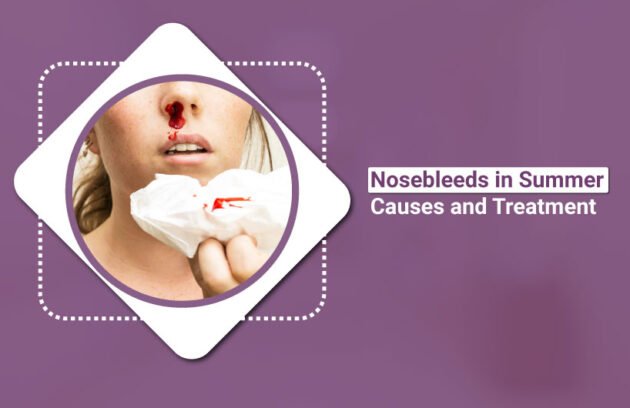 Nosebleeds-in-Summer-Causes-and-Treatment