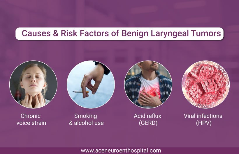 Causes and Risk Factors Benign Laryngeal Tumors