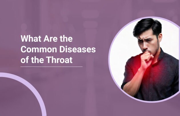 Common Diseases of the Throat
