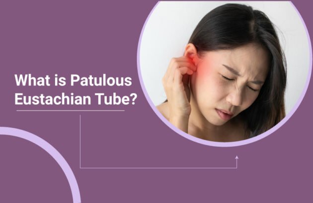 What is Patulous Eustachian Tube