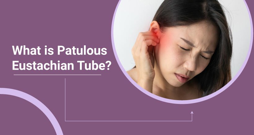 What is Patulous Eustachian Tube