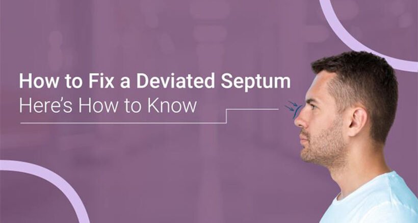 How to Fix a Deviated Septum Without Surgery 1