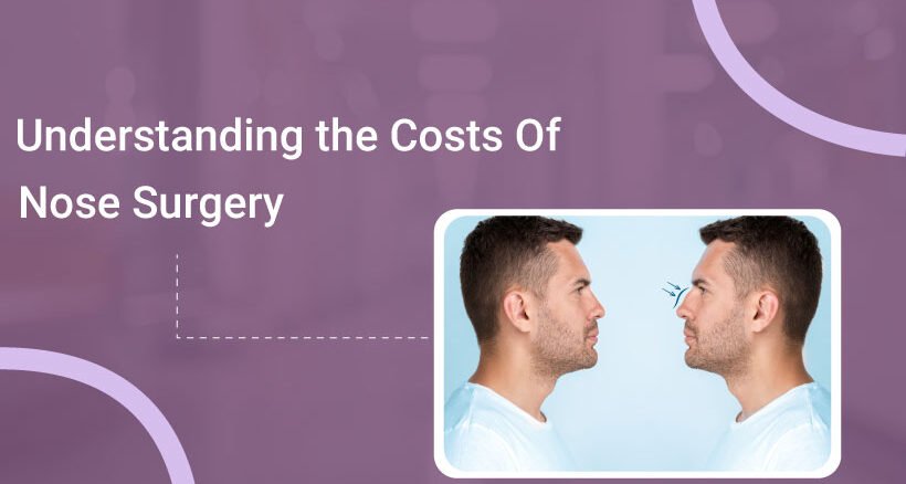 Understanding the Costs of Nose Surgery