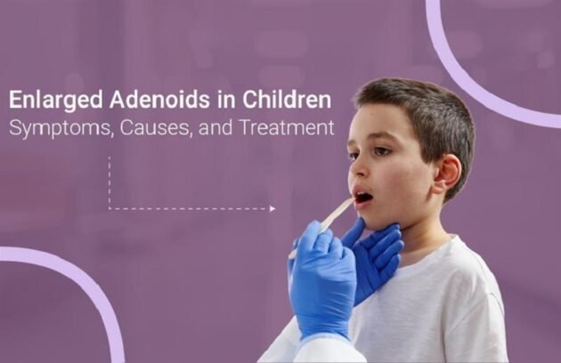 Enlarged Adenoids in Children
