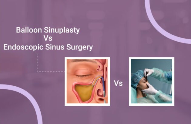 Balloon-Sinuplasty-vs-Endoscopic-Sinus-Surgery