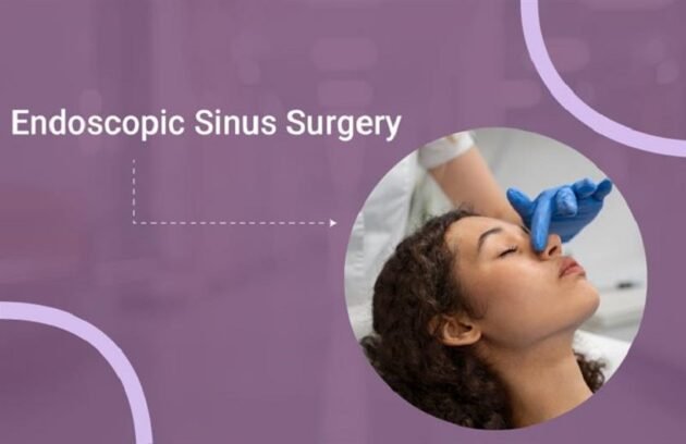 Endoscopic Sinus Surgery