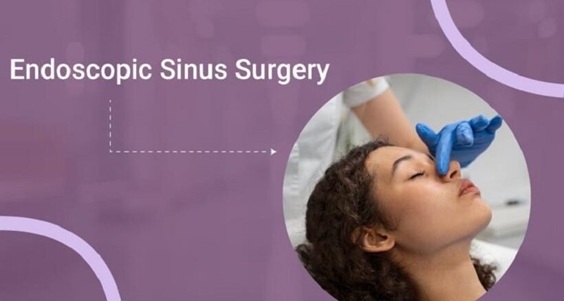Endoscopic Sinus Surgery