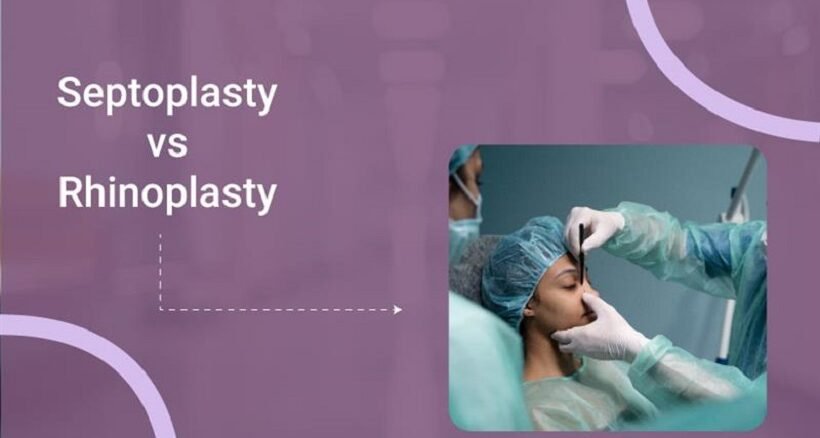 Septoplasty vs Rhinoplasty