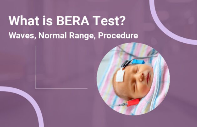 What is BERA Test