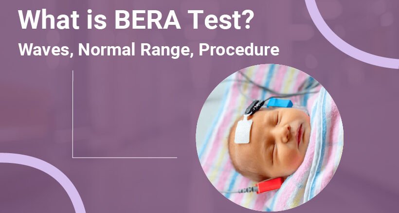 What is BERA Test