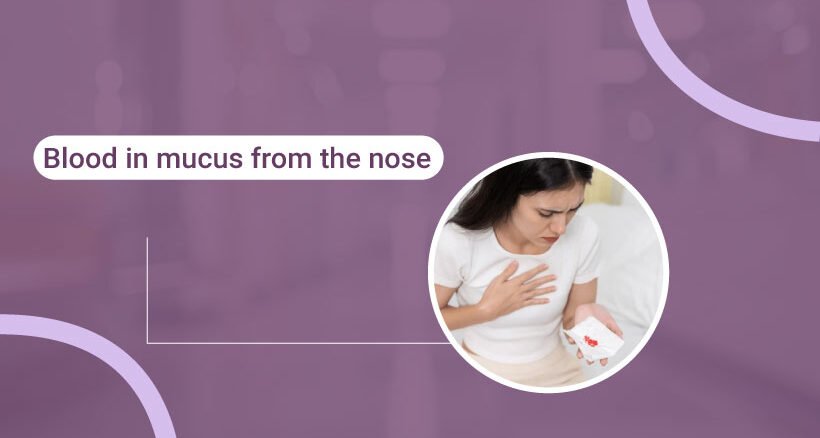 Blood in Mucus from Nose