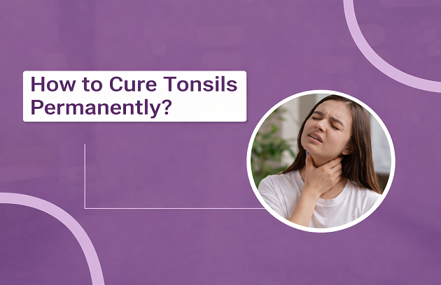 How to Cure Tonsils Permanently
