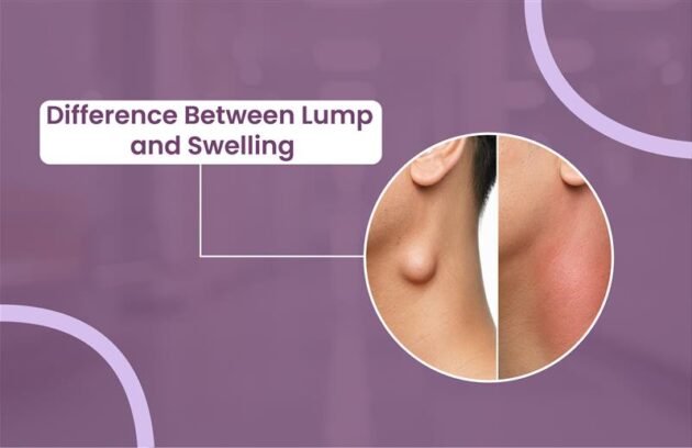 Difference Between Lump and Swelling