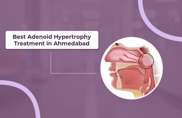Best Adenoid Hypertrophy Treatment in Ahmedabad