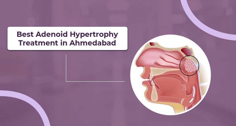 Best Adenoid Hypertrophy Treatment in Ahmedabad