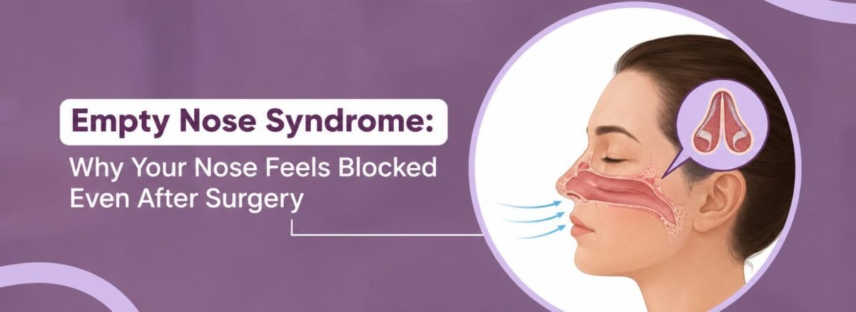 Empty Nose Syndrome