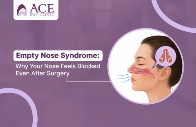 Empty Nose Syndrome