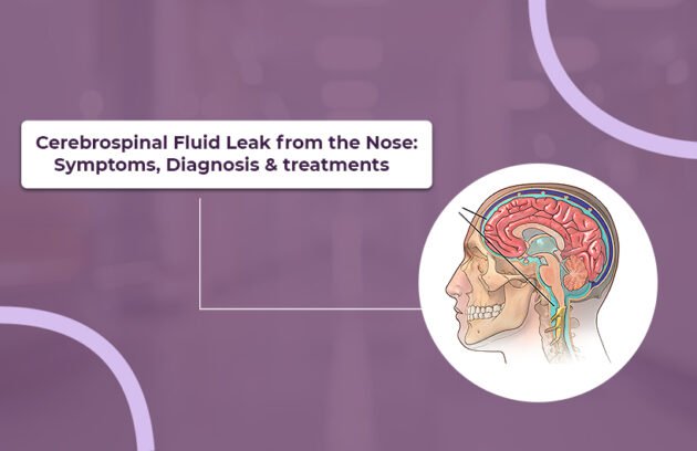 Cerebrospinal Fluid Leak
