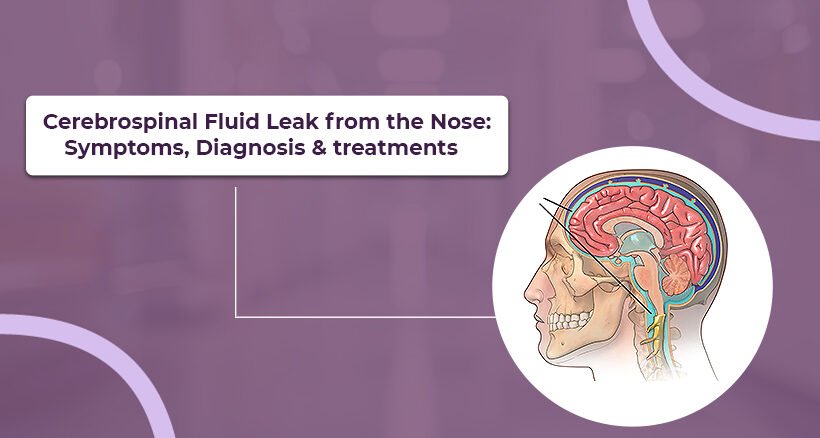 Cerebrospinal Fluid Leak