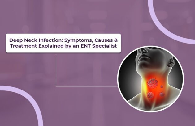Deep Neck Infection