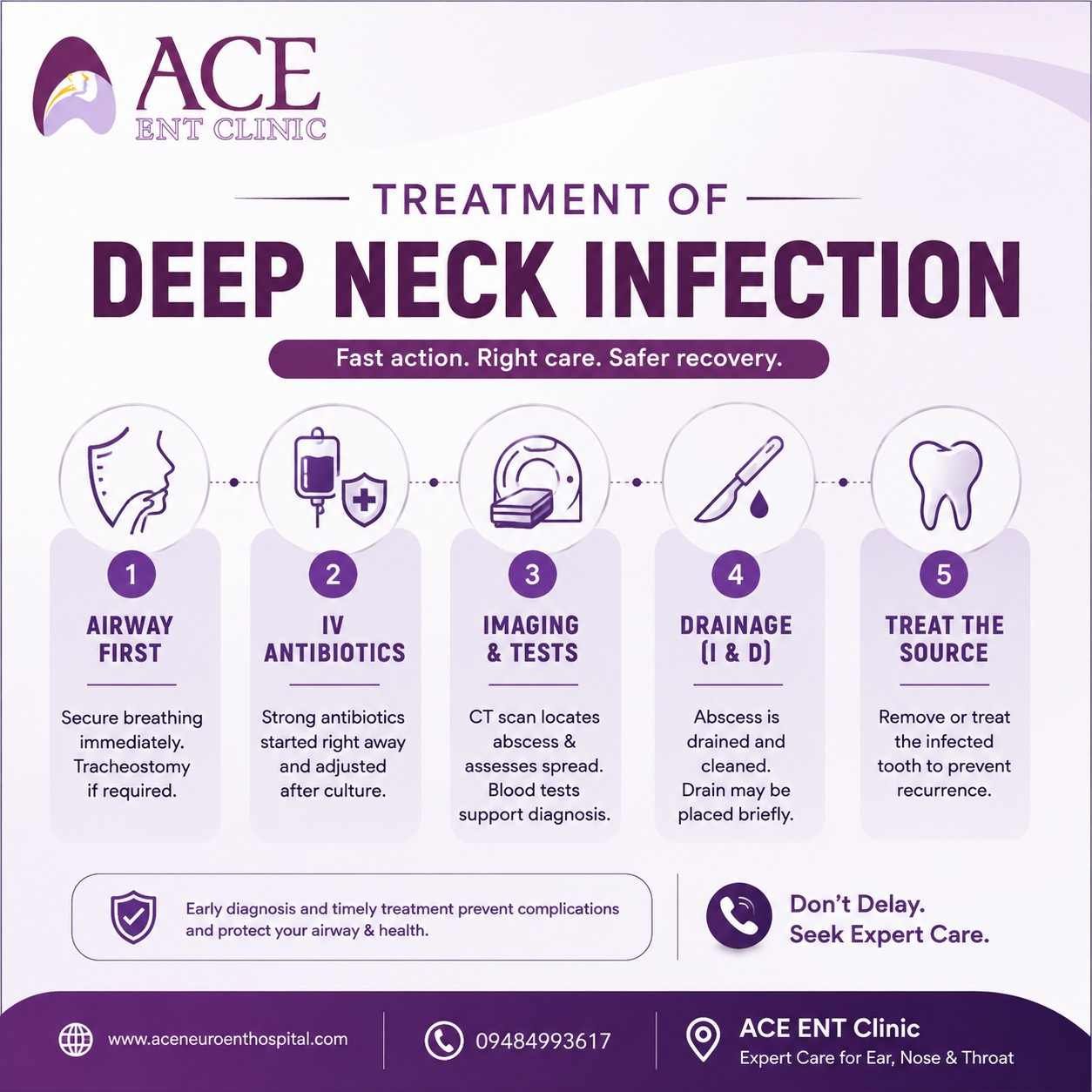 Treatment of Deep Neck Infectio