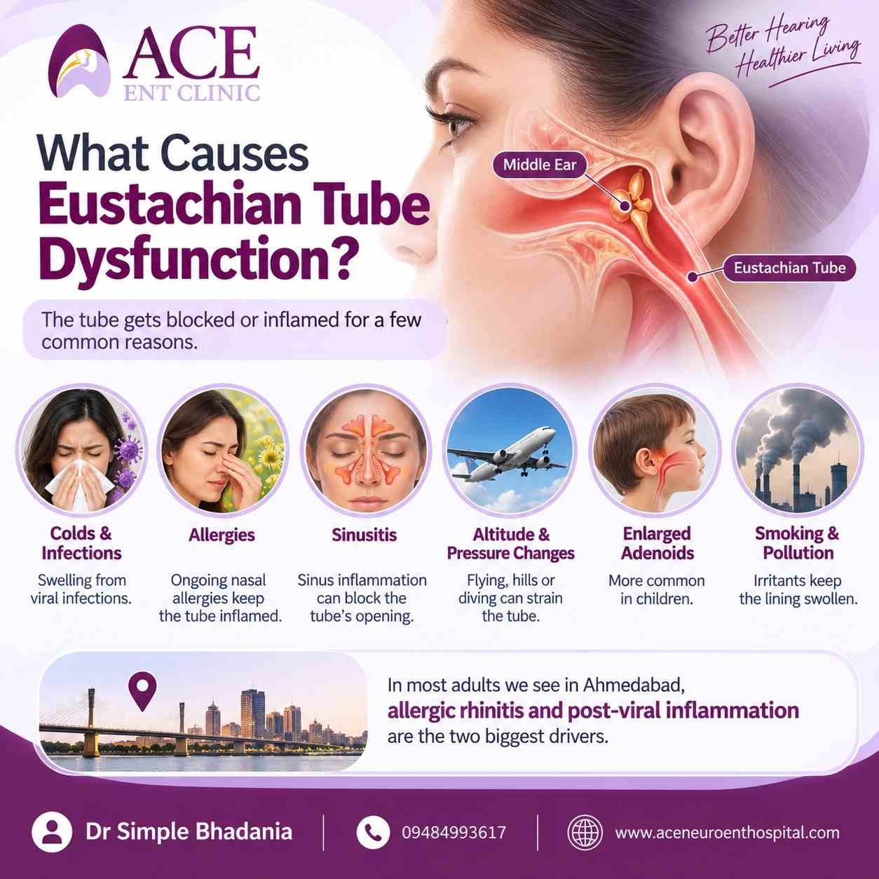 Causes of Eustachian Tube Dysfunction