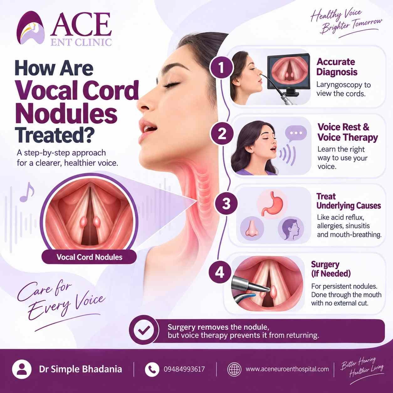 Vocal Cord Nodules Treatment