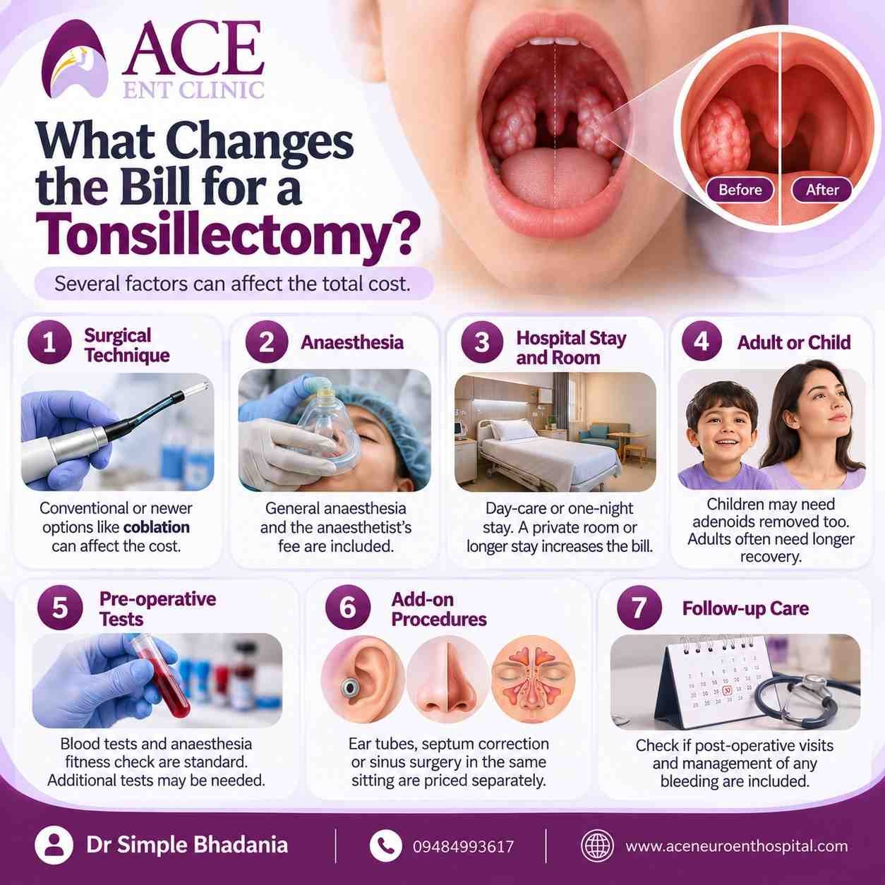 Bill for a Tonsillectomy