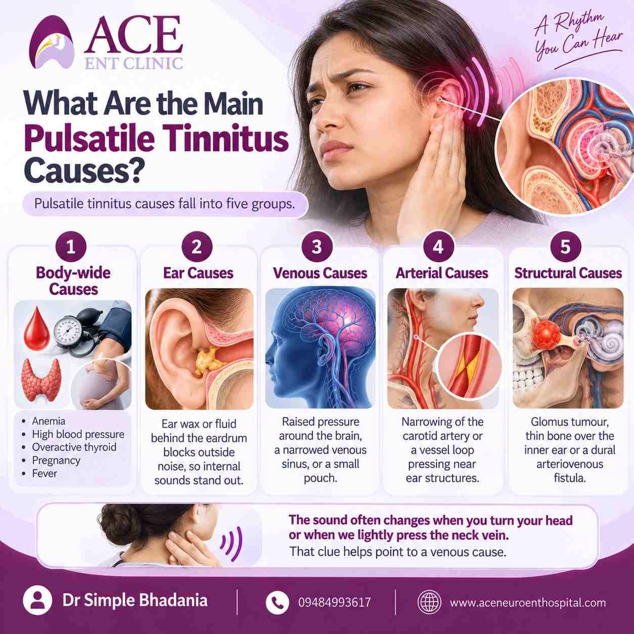 Pulsatile Tinnitus Causes