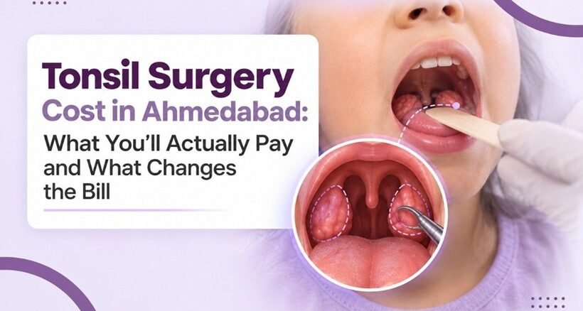 Tonsil Surgery Cost in Ahmedabad